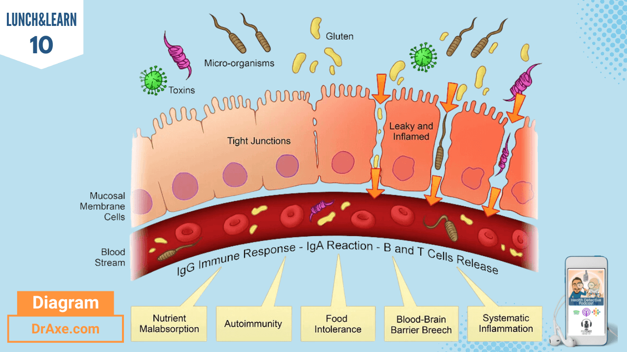 MUCOSAL BARRIER & LEAKY GUT, MUCOSAL BARRIER, LEAKY GUT, LEAKY GUT SYNDROME, GUT HEALTH, GUT ISSUES, INTESTINAL PERMEABILITY, DETECTIVE EV, LUNCH&LEARN, EDUCATIONAL, FDN COURSE, FDN, FDNTRAINING, HEALTH, DR.AXE