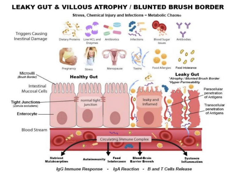 gi map leaky gut stool test 